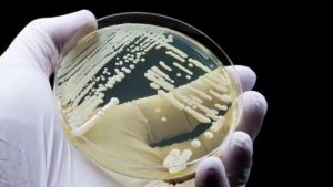 Scientists in China have discovered a previously unknown fungal pathogen that can infect humans