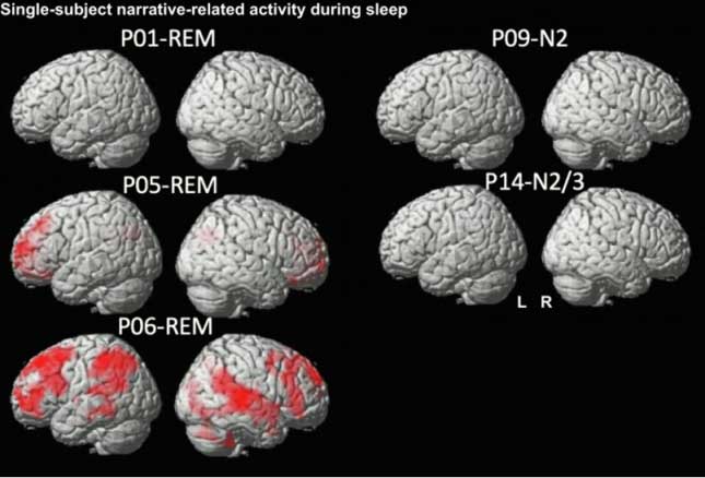 Pendant le sommeil, des ondes électriques lentes poussent les déchets des profondeurs du cerveau